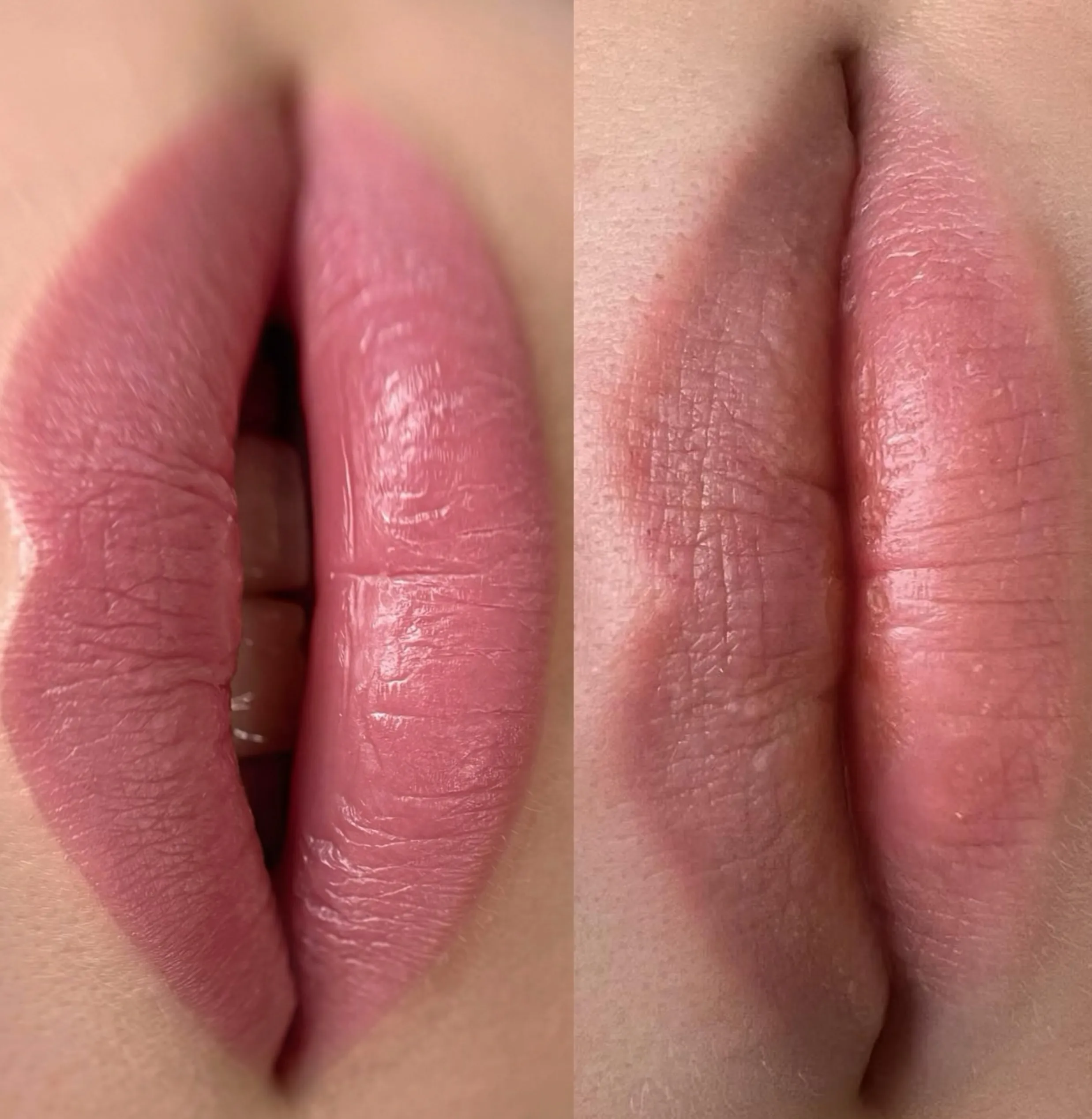 lip tattooing before and after, melbourn