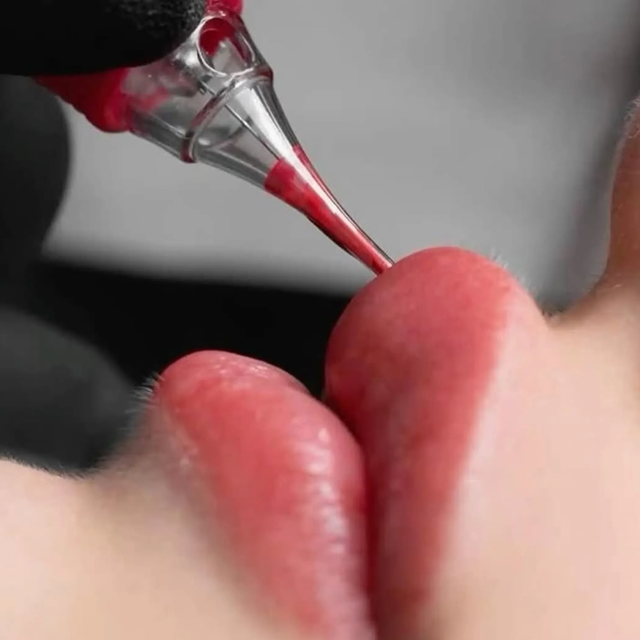 cosmetic lip pigmentation procedure
